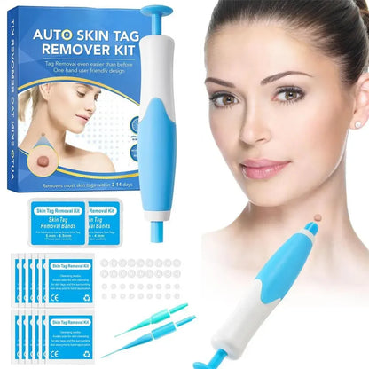 Painless Skin Tag Removal Kit