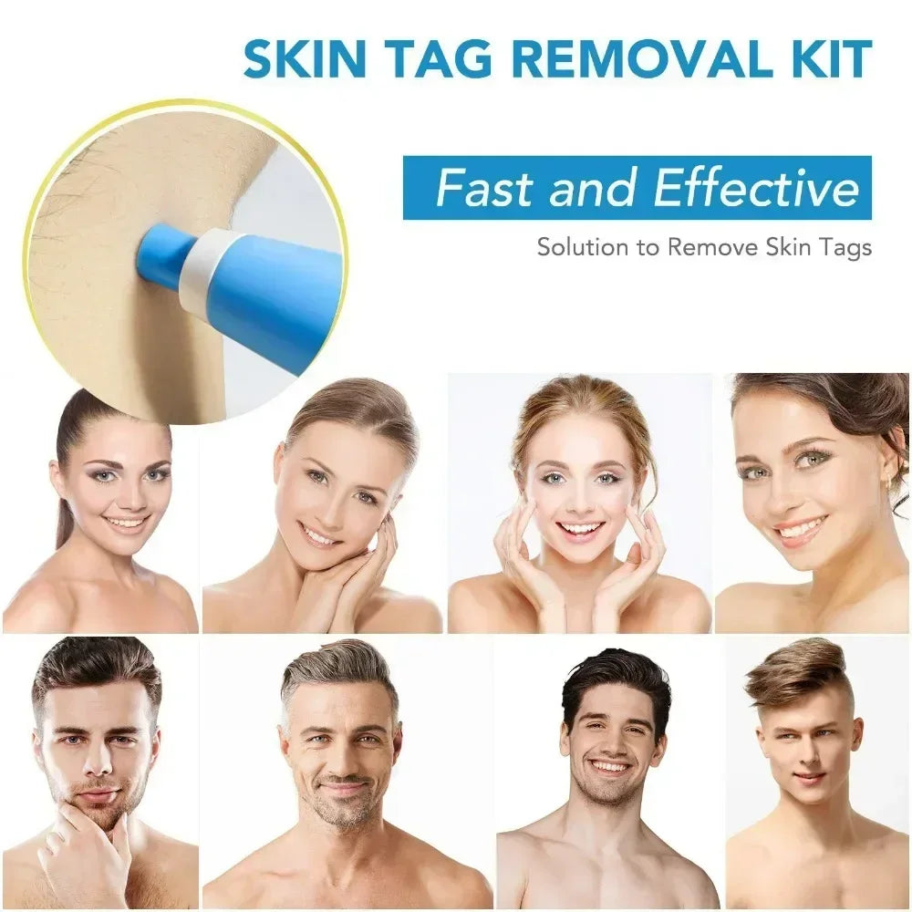 Painless Skin Tag Removal Kit