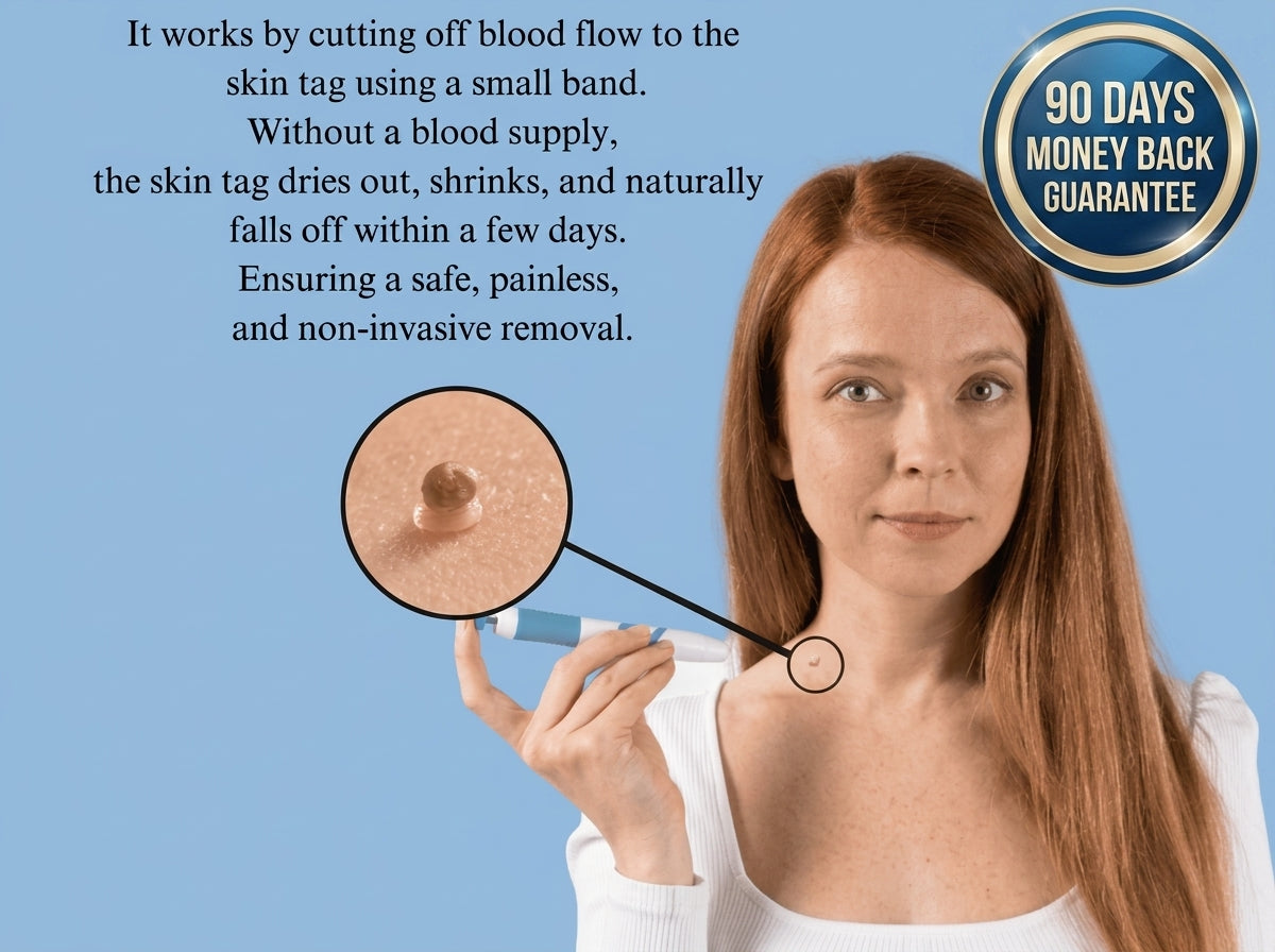 EaseWelly SkinEase™ | Skin Tag Removal Kit