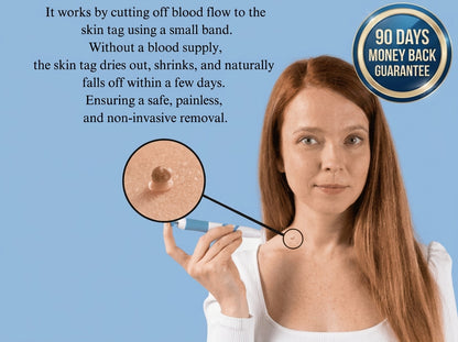 EaseWelly SkinEase™ | Skin Tag Removal Kit
